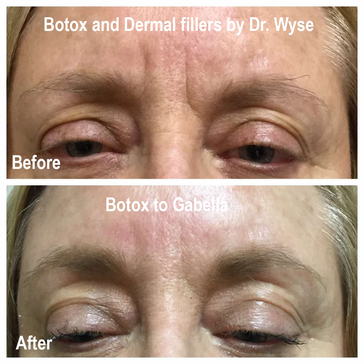 Dr, Wyse Before and After